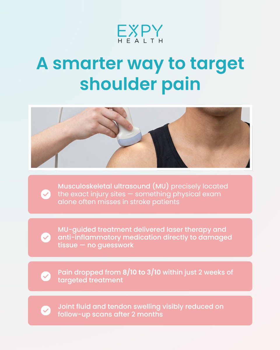 ExpyHealth's tweet photo. Up to 84% of stroke survivors develop shoulder pain and it's often missed because standard exams can't pinpoint the source. A new case report used real-time ultrasound imaging to guide PT precisely to the injury. Pain dropped from 8/10 to 3/10 in 2 weeks.
#StrokeRecovery https://t.co/SgxAm9Ubx9
