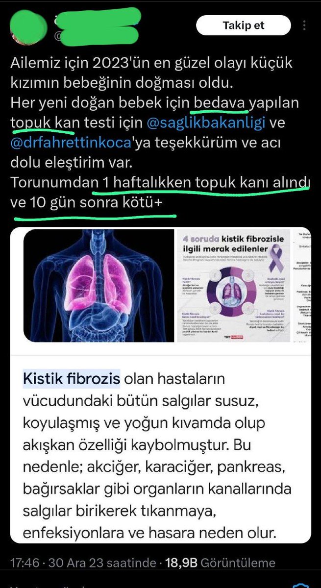 ervaxs09's tweet photo. Kabaal Bilimi sorgulayan  bir vatandaş :) Torunu için bir flood yazısı yazmış ancak yazıda akla mantığa uymayan pcr sahtekarlığını ortaya Net koyan cümleler kuruyor. bilmeden hakikkati itiraf ediyor! 
Az akletse dönen çark sistemini anlayacak ! https://t.co/GfrHUNAYHA