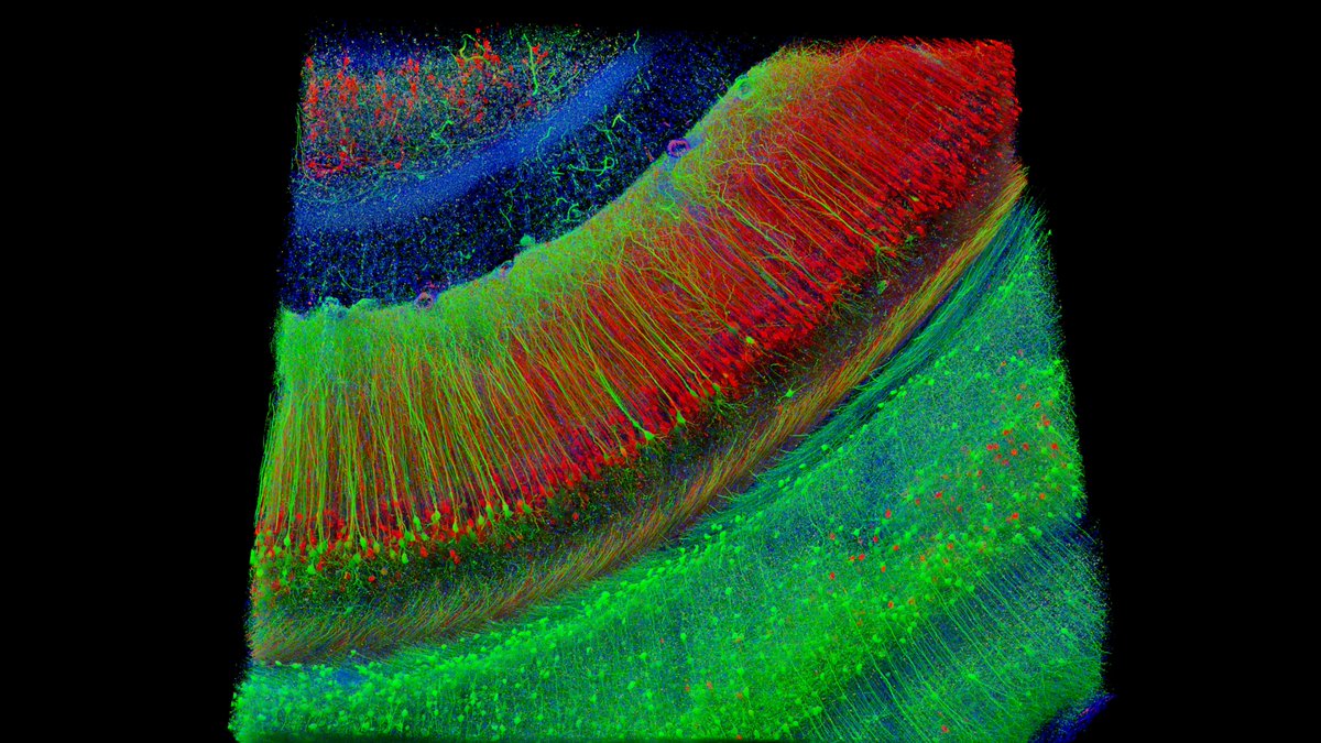USCLONI's tweet photo. Our Spring Newsletter is here 🌱

Catch up on the latest, including new research on Alzheimer’s risk and stroke recovery, faculty honors, AI-driven discovery, student training, and more.

Read the full issue: https://t.co/TDp9WeS1dC https://t.co/uk6MfEnldb