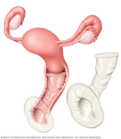 Johnnyhand's tweet photo. @MVGNETDUBS @NBanney @camillamonk @RealPostFolder You mean the ones that have an obvious entry and are meant to protrude across the vulva for easy removal after use? That kind? https://t.co/2YoaawkRXO