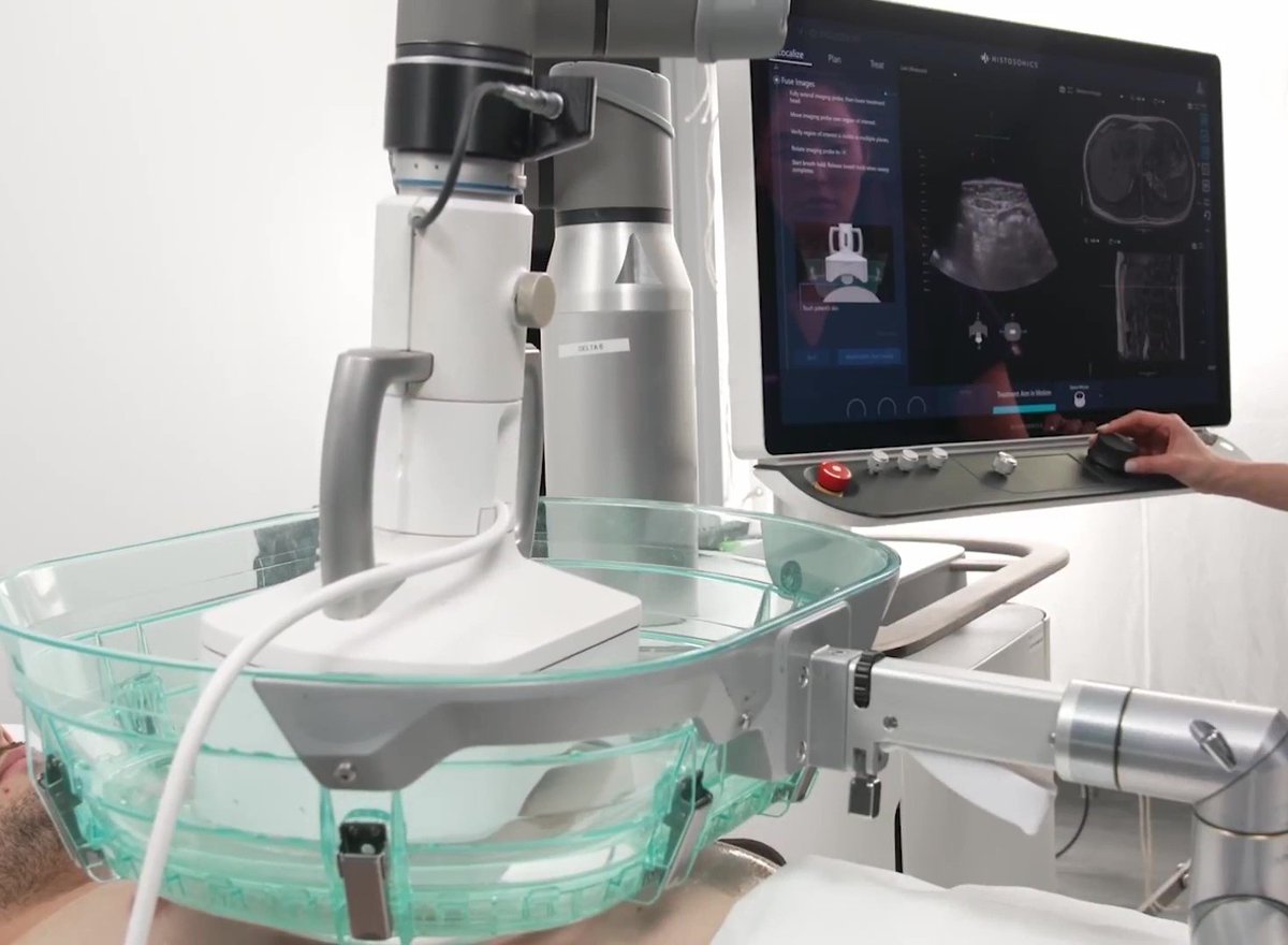 LeeHealthCancer's tweet photo. Imagine treating a tumor without an incision. That’s the power of histotripsy. https://t.co/8pI09aliH7