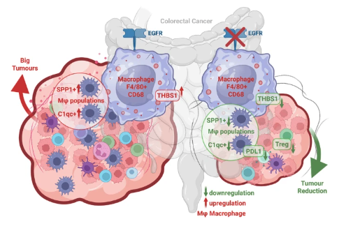 cddpress's tweet photo. “EGFR deletion in myeloid cells reprograms the immunosuppressive landscape of colorectal cancer”

A groundbreaking multi-omics study from @CCR_SibiliaLab reveals EGFR in specific myeloid cell subsets as a potential new therapeutic target in mCRC ⤵️
https://t.co/copfy9tTE6 https://t.co/f7mBDfMRbO