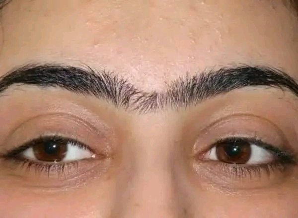 kh505043's tweet photo. What is the medical term for the confluence of the eyebrows in the middle? And what causes it?😳😳
. https://t.co/Ve8f8cfBW8