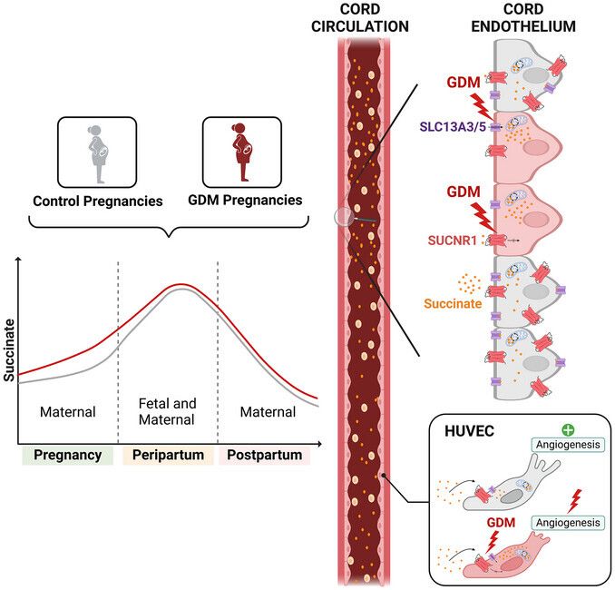 JPhysiol's tweet photo. #Research by Sergiy Klid (@universitatURV) and colleagues concludes that impaired #angiogenesis in gestational #diabetes is linked to succinate/SUCNR1 axis dysregulation in late gestation 🔬 💉 

Read the study👇️ 
https://t.co/NcafdiP8zj https://t.co/NzxledMeCZ