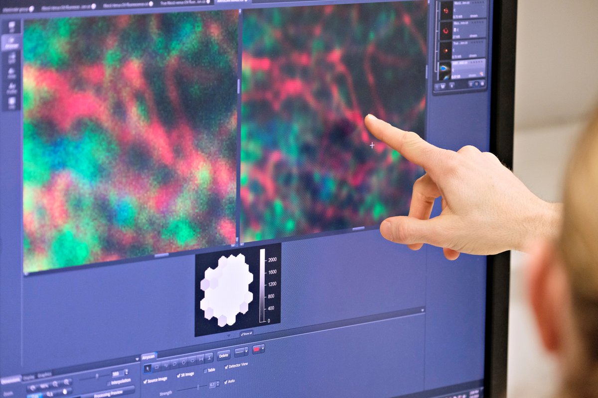 YorkBioimaging's tweet photo. Our 100% recommended Hands-on Confocal #Microscopy course is still simply the best.
Open to all
https://t.co/5yNKioty0i
Highly interactive, engaging, and fun! Includes accommodation and most meals.
Pls share https://t.co/crbtgpTHaH