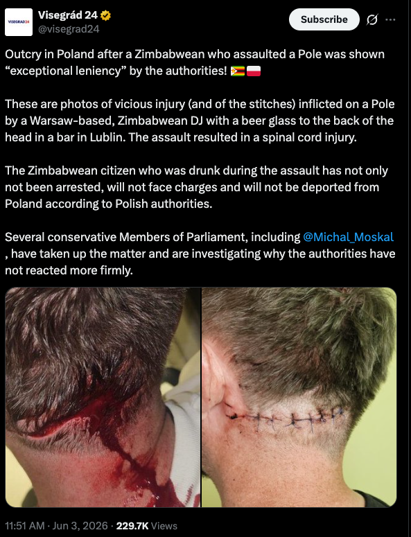 l8explorer's tweet photo. @JanGrolich muzes si jit treba vymenit misto s timhle a ukazat jak se bojuje proti podnecovani nenavisti ty zbabelce https://t.co/nfJKOz9ITL