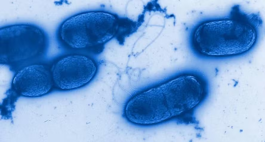 forumbunklr's tweet photo. 🚨⚠️ URGENTE: Anvisa mandar recolher 374 mil garrafas da água mineral CRYSTAL contendo a MESMA BACTERIA que foi encontrada nos produtos Ypê.

Gente? https://t.co/fuuwisVrly