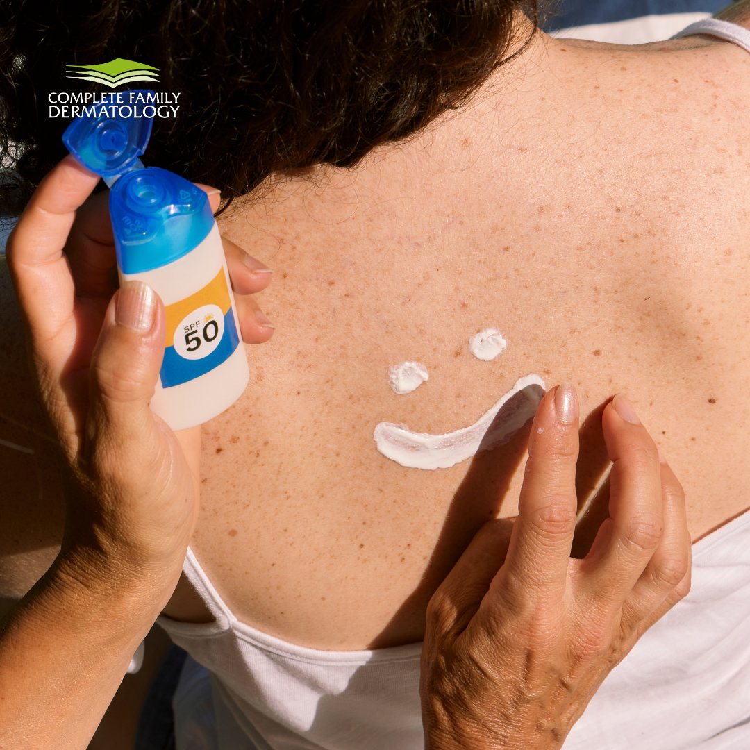 CompleteFamily7's tweet photo. Summer fun starts with sun protection! 🧴🏖️

Wearing sunscreen daily helps prevent sunburn, premature aging, and skin cancer — keeping your skin healthy all season long. Don’t skip the SPF! 💚

#skin #skincare #clinic #dermatologyclinic #derma #dermatology https://t.co/avKWsdmcZR