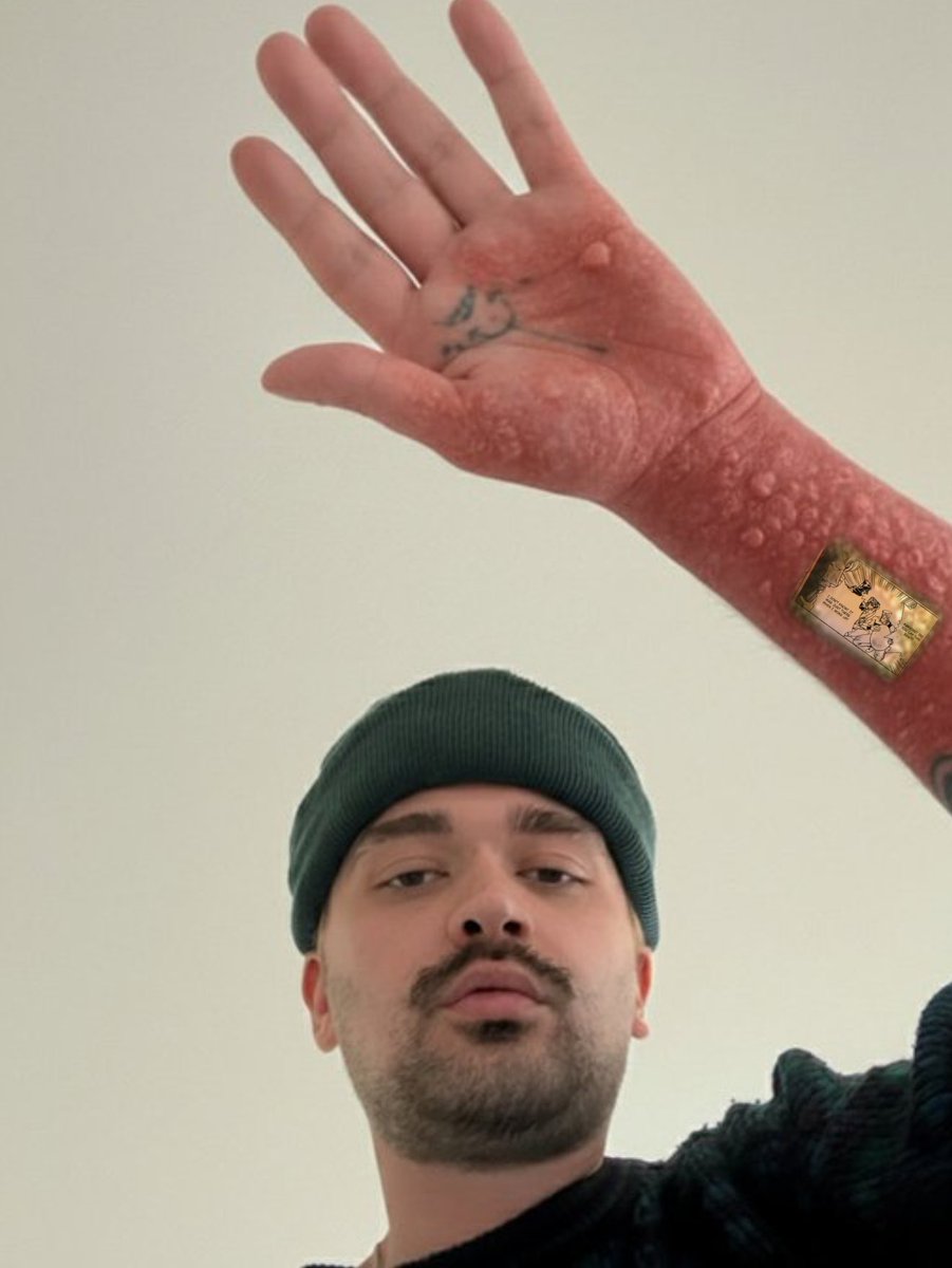 asinglequeef's tweet photo. Random r/ShitpostCrusaders  dweller is going to die from getting the infamous "Kakyoin, did you lay this egg?" panel tatted on his forearm using a poopoo needle! https://t.co/HWKBat1hhZ