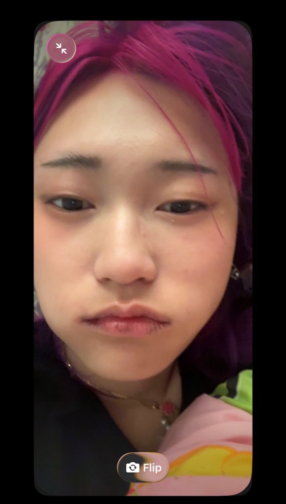 YUUPHOBlC's tweet photo. wisdom teeth removal today they took out all 4 n now i’m swollen with gauze in my mouth 😭😭😭😭 https://t.co/371y3V4Kst