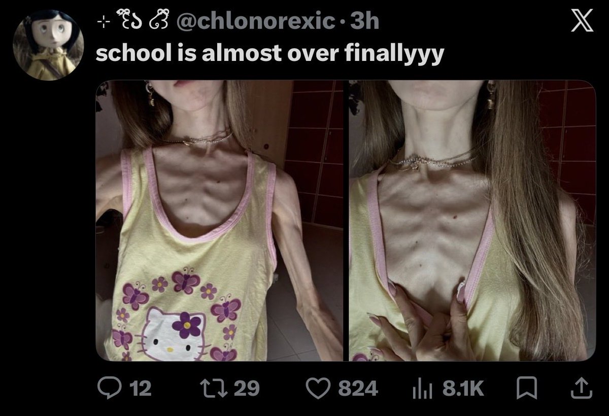 _echova's tweet photo. Can we stop acting like this is a flex https://t.co/iMOLmAKulE