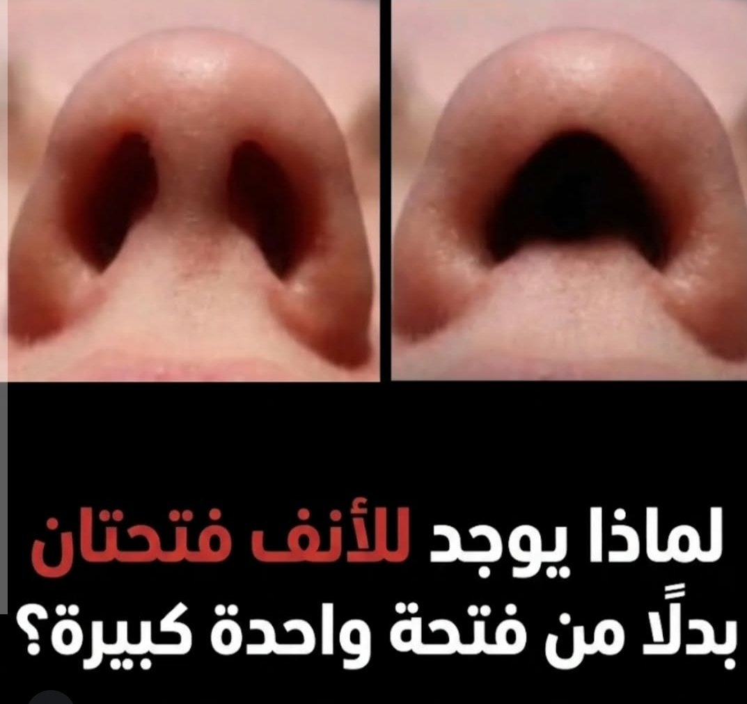 hhyf0's tweet photo. لماذا يا @grok https://t.co/KrzdHrrzFM