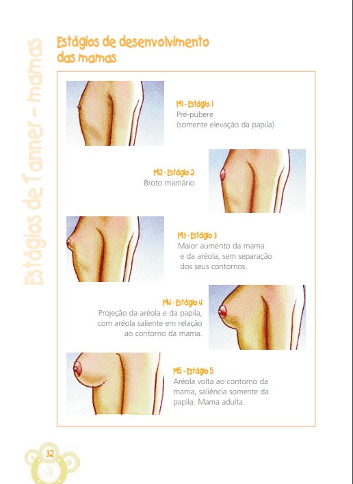 dog_onSpac3's tweet photo. @Baphomeeettt Mama, ou normalmente intituladas como "peitos", é o conjunto musculo/adiposo/mamário do homo sapiens, responsaveis pela amamentação e apoio crucial no movimento dos braços. A diferença do masculino para o feminino é seu estágio na linha de desenvolvimento de tanner (imagem 2) https://t.co/RX1iyHGQ84
