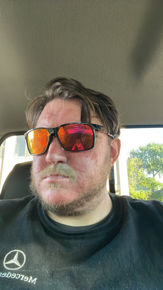 R600Luke's tweet photo. @BarstoolBigCat @FizPhoto Orange lens Oakley’s https://t.co/cgROjdxHFP