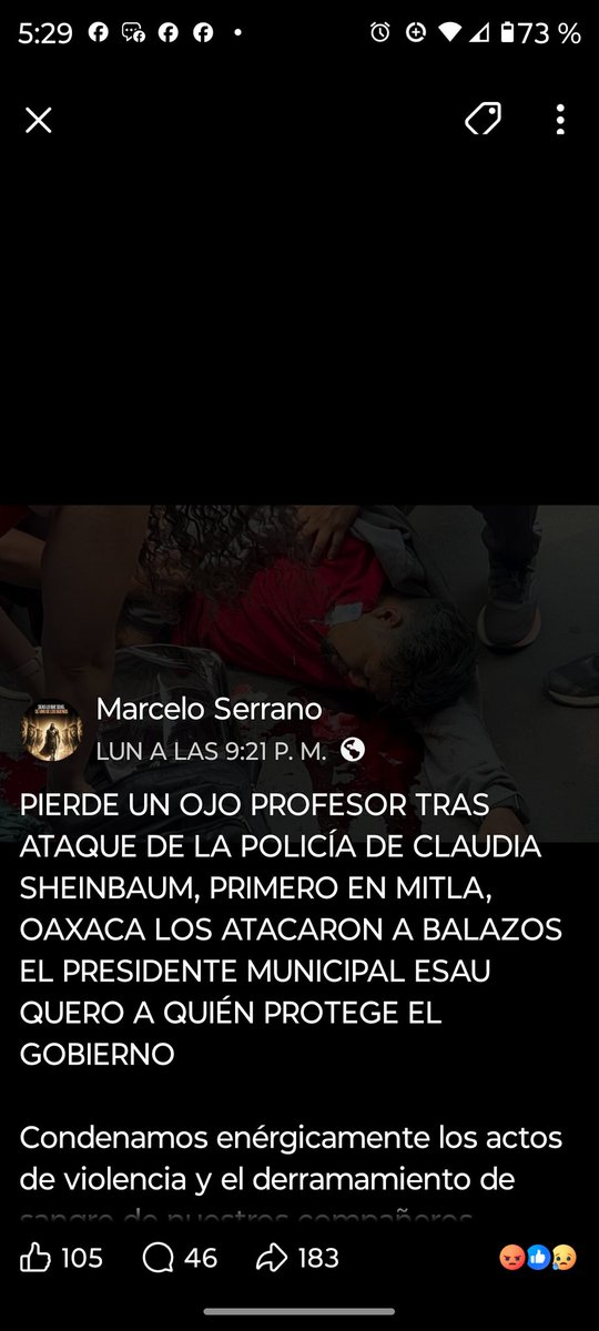 MariaA97598's tweet photo. Falsa como nadie y no es más farsa por qué no le da el tiempo a está miserable rata
Quién creen que Dios la orden de agredir a los maestros, no estoy a favor de ellos, pero se los prometió ella, en su campaña y ahora se hace pendeja la 🐀de💩 y los agredio
https://t.co/EuhTdOmK00 https://t.co/15n8S77J25