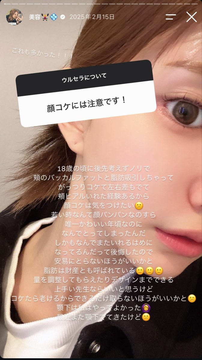 m_b_d_f_00's tweet photo. ヒアルで調整💉でこんなに変わる https://t.co/4GYgRmKvC0