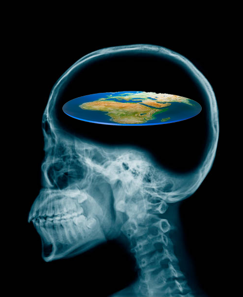 FlerfWatch's tweet photo. The Flat Earther brain is truly remarkable

It takes the entire observable universe and centuries of physics, then lobotomizes itself to believe Earth is a pizza on a snow globe guarded by ice walls

All hidden by the Jews, NASA, and Big Government of course. 

Clinical levels of stupidity