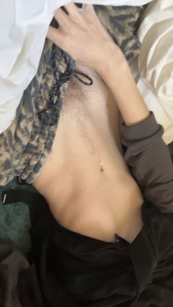 twigsly_'s tweet photo. morningn https://t.co/QMd3oWqXFT