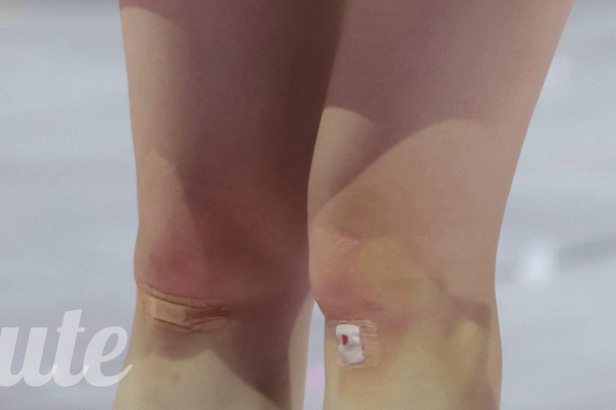 ミナ Post by み on X: ouch 😣