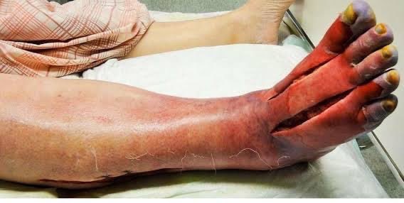 Sage_medics's tweet photo. Name the procedure?? 
What’s the clinical use??? https://t.co/gQ7Zvj7L1q