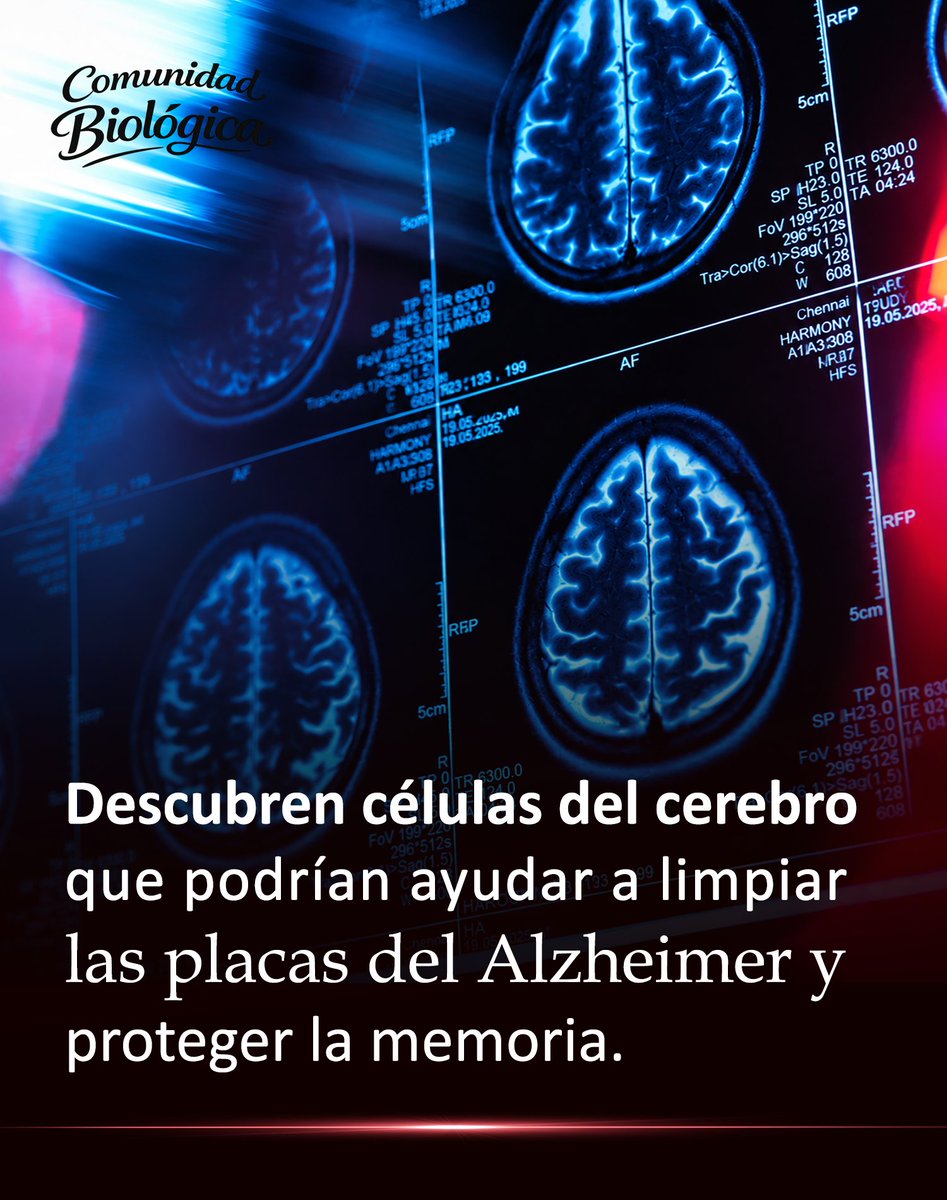 Bio_comunidad's tweet photo. Dentro del cerebro podría estar ocurriendo algo extraordinario: científicos descubrieron células capaces de ayudar a limpiar las placas del Alzheimer… mientras protegen la memoria.

Mayor info: https://t.co/aptPpMuwI9 https://t.co/kSi6W4nCl4