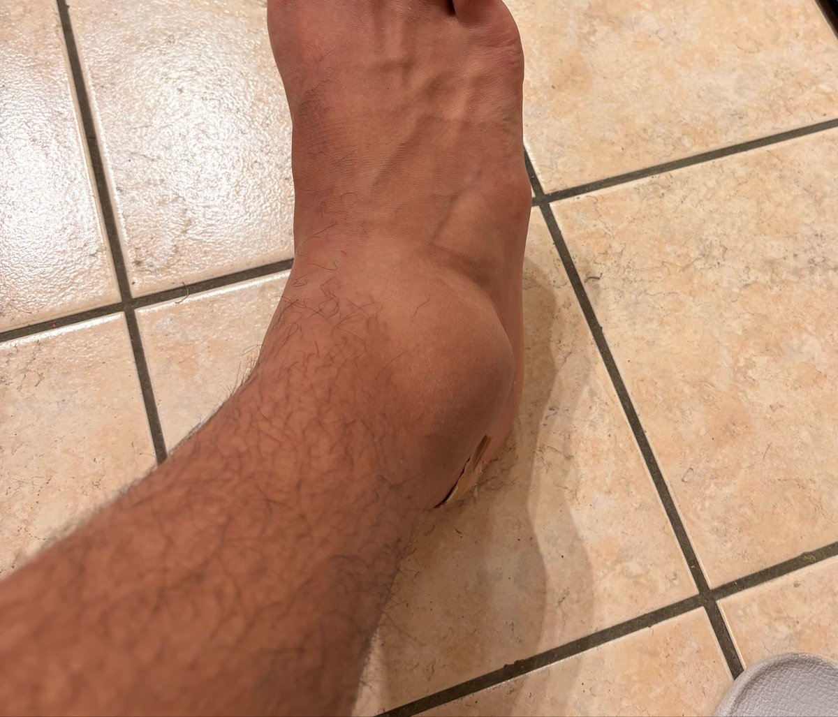 Alexside11's tweet photo. Ah ouais j’avais oublié ce tweet de merde… Update : j’ai eu l’entorse https://t.co/VLtgGCzX5g
