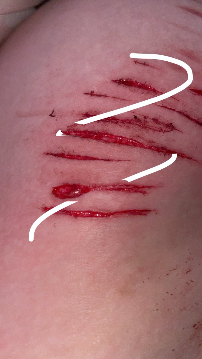 EmilyBroyles13's tweet photo. Beanies and styros!!!
Tw: totally fake!!!!!!

#ouchie #slittertwt #beans
#styro https://t.co/i9rU6Rbk4o