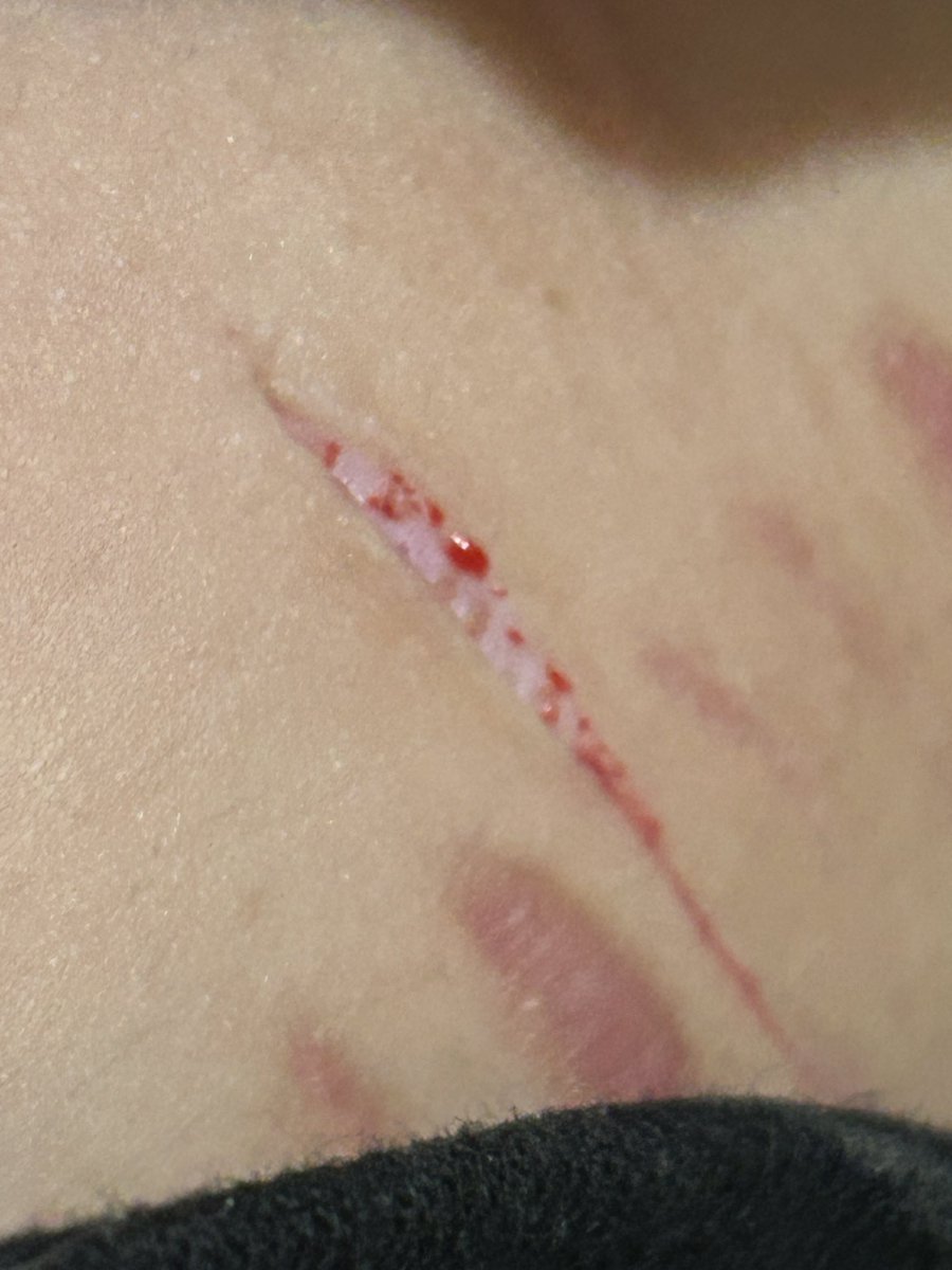 LikeToast40802's tweet photo. One swipe baby beans, believe me believe me not (relapse after a month) #shtwt cuttwt slittwt https://t.co/PLFCeCIeoq