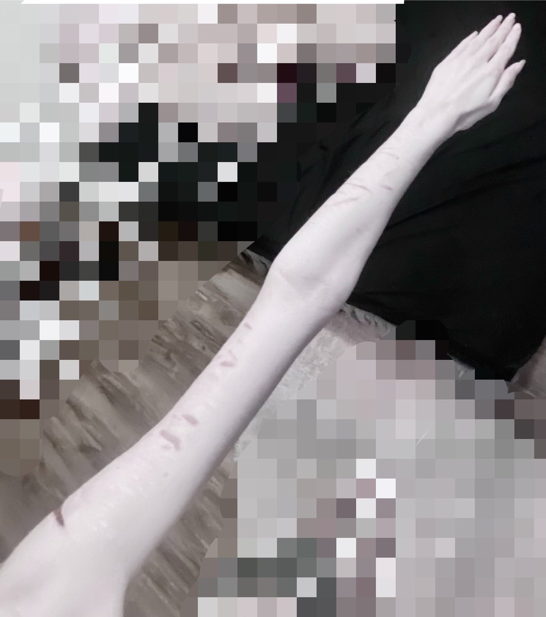 acheydream's tweet photo. // bodycheck

arm and leg 🐱 https://t.co/8lYR90UL68