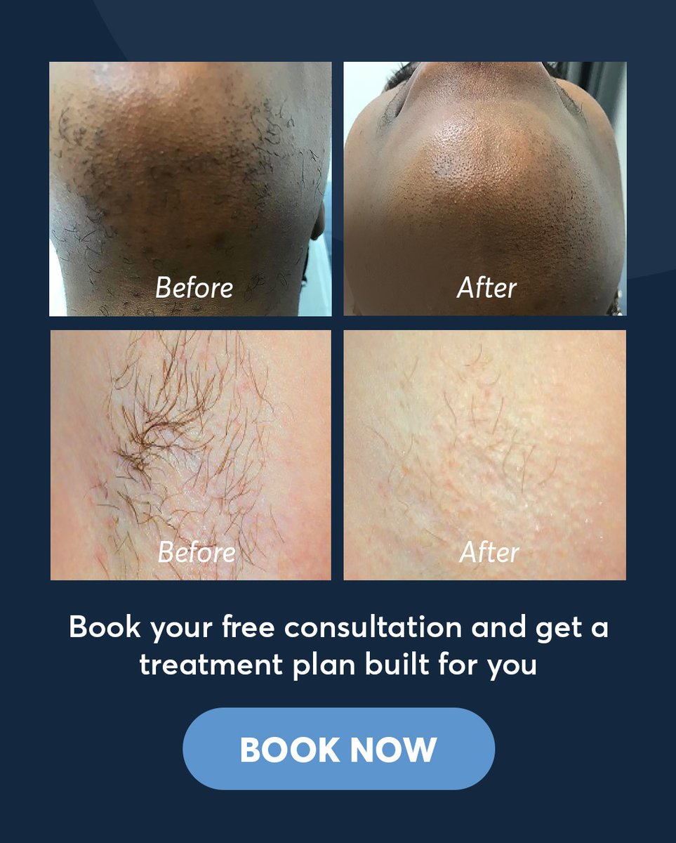 pulselight's tweet photo. Get the best results.

#PulseLightClinic #LaserHairRemoval #LondonClinic https://t.co/MsDNo9cibw