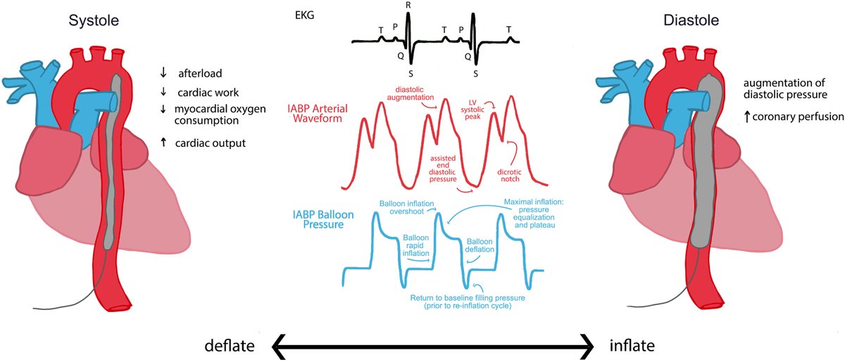 CritCareReviews's tweet photo. Today's Paper of the Day is:

The Intra-Aortic Balloon Pump: A Focused Review of Physiology, Transport Logistics, Mechanics, and Complications

https://t.co/JKgcYjlUQ5

Join us to read 1 paper per day and stay up-to-date as we cover the spectrum of critical care across 2026 https://t.co/2OqMT1MJd3
