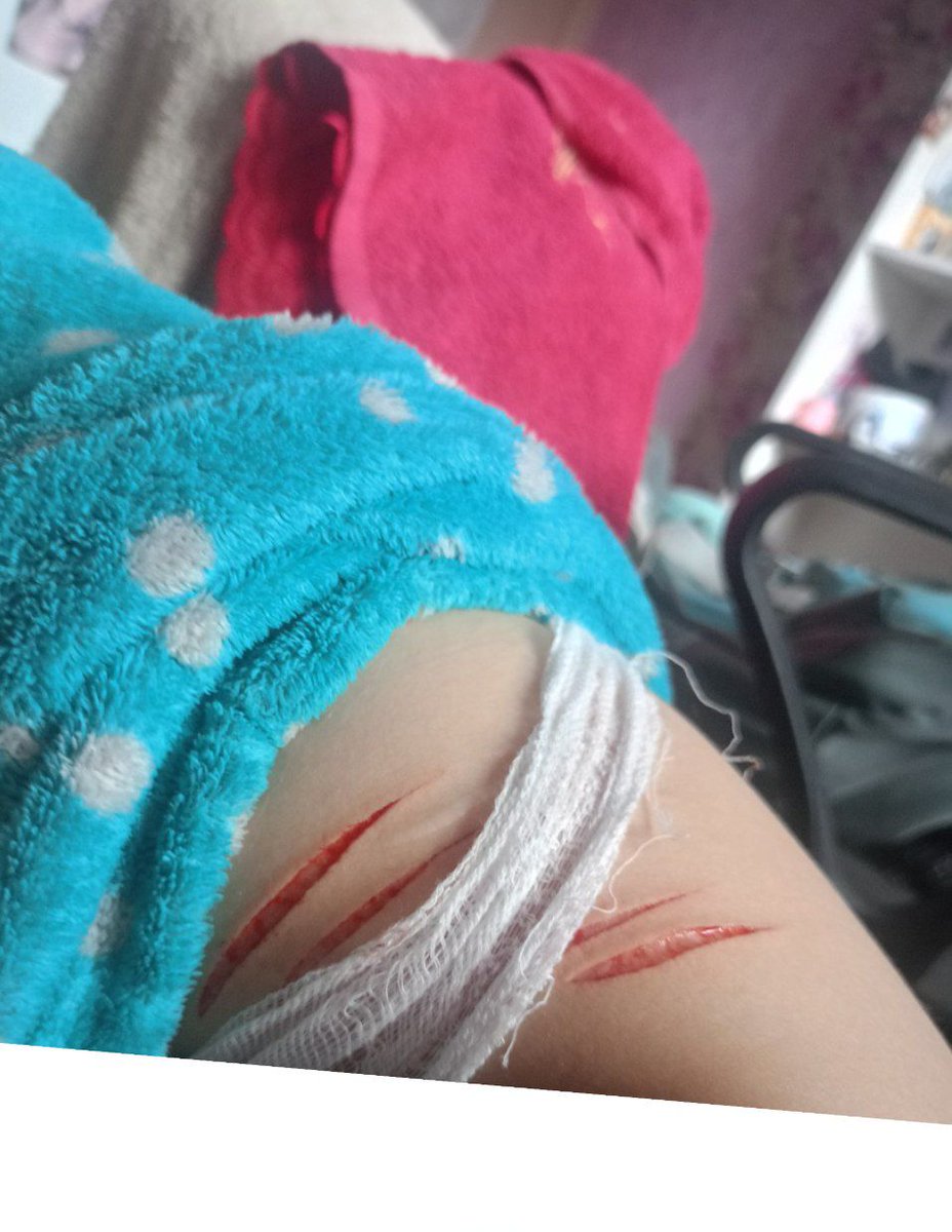 sweeetttrelapse's tweet photo. hello I was clean for 8 months but relapsed yesterday #shtwt https://t.co/3eTQtoNdZm