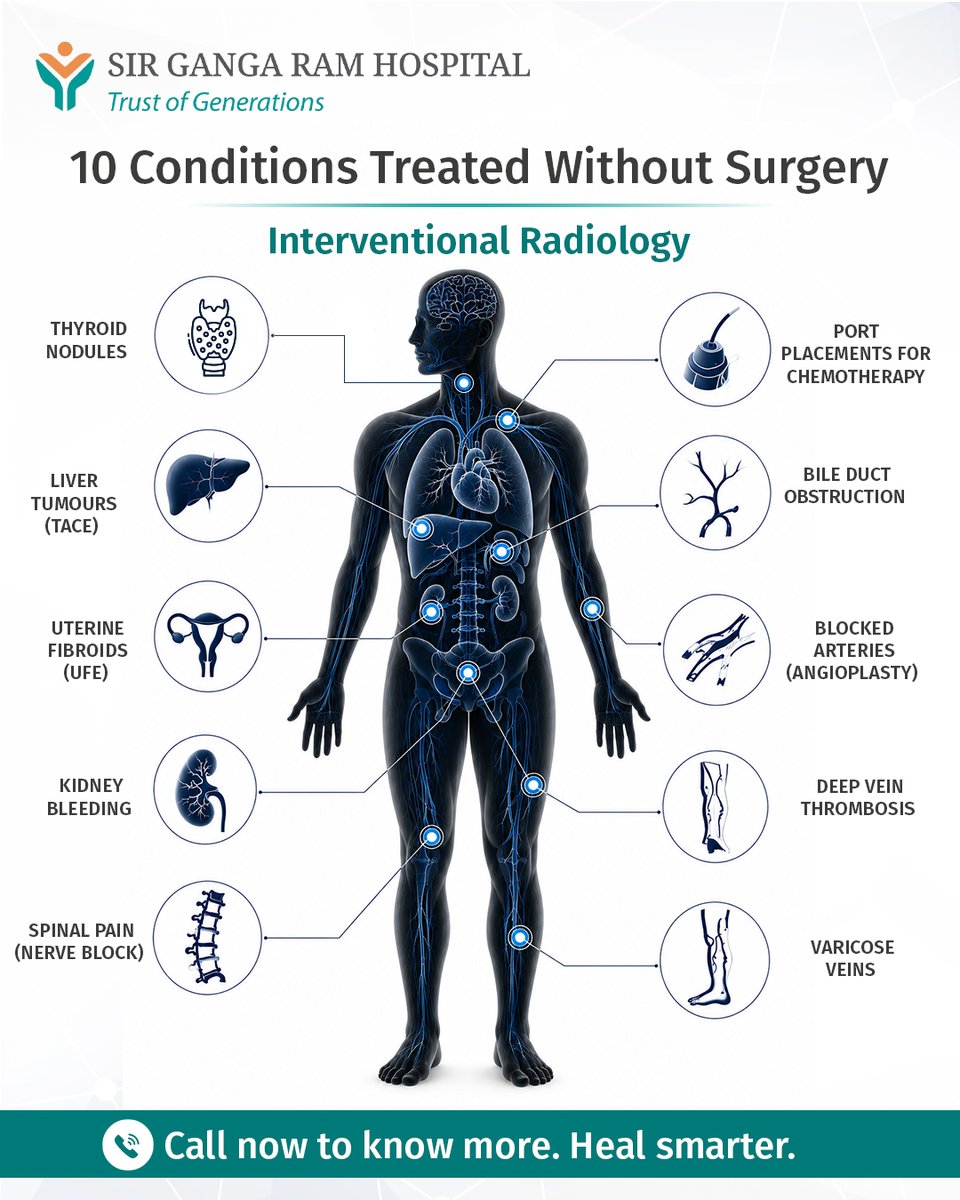 sgrhindia's tweet photo. A medical revolution is quietly transforming healthcare - treating complex conditions with precision, minimal incisions, and faster recovery.
To know more click: https://t.co/2StXHf07Tu or call at +91 11-42254000
#sgrh #bondoftrust #trustofgenerations #interventionalradiology https://t.co/lwnHgMq3Hw