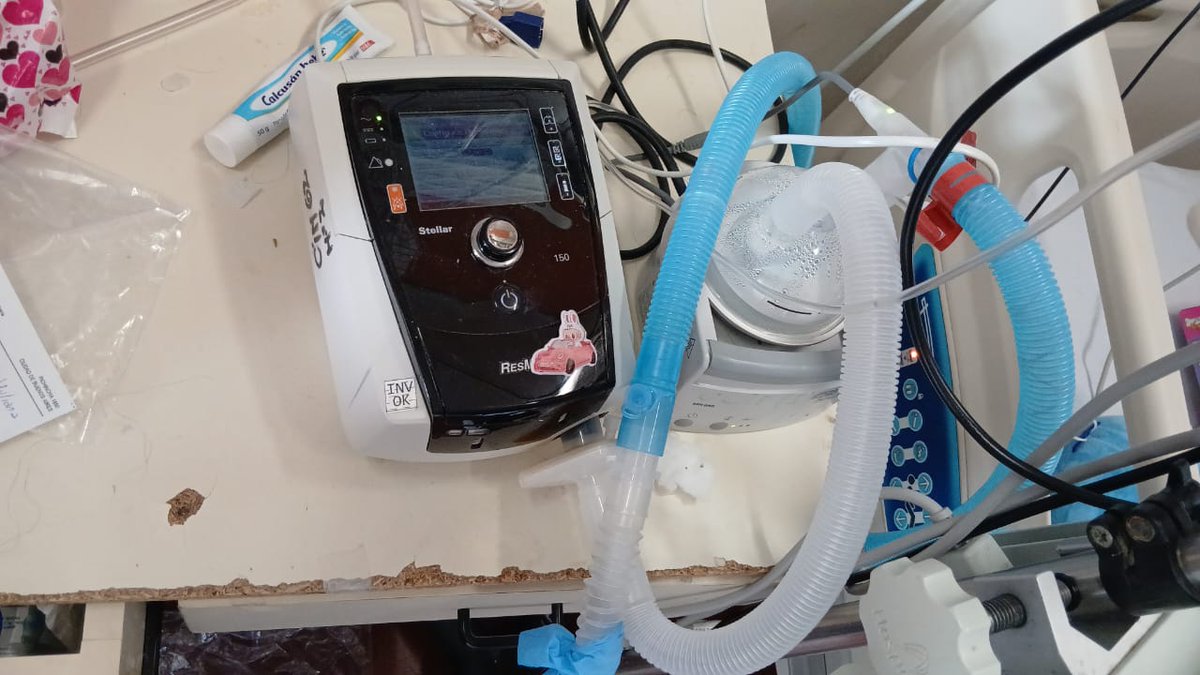 AnyColazo's tweet photo. Actualizamos Yuli tiene 5 padece Leucemia, necesita ir a casa. Para ellos requiere un Bipap  q sale 3.000.000 Nos ayudas a lograrlo?Si 30000 personas donan $100 o 3000 donan $1000 llegamos ALIAS https://t.co/bj1UXMFltX @churreriaeltopo un rt? https://t.co/i6jUt5yxH2