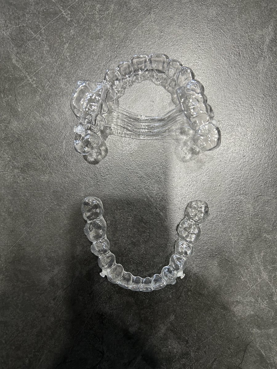 tatsu_iidx0301's tweet photo. #Smartee
#歯列矯正
2/40枚目☺️
毎週土曜日の夕方に交換🦷
オルソヒーリングしてもできれば6日交換って言われたからやらないことにした。
上顎の左右に突起が付いてて強制的に正中が常に合うようになってる。その位置だと今は前歯閉じてないけど綺麗になる予定✨
ゴム掛けもダブルで。 https://t.co/uJi3vlJp7F