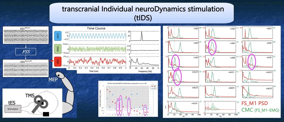 ClinicalNeuroph's tweet photo. [Neuromodulation] Tecchio et al.: "We are pleased to offer this bridge between the tECS framework and the seminal observations introduced by tIDS." https://t.co/bvzMFjqpZI
#tECS: Transcranial Endogenous Current Stimulation
#tIDS: Transcranial Individual NeuroDynamics Stimulation https://t.co/rZs3RsYuyW