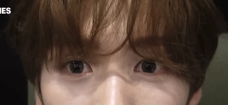영재 쌍커풀 tweet media