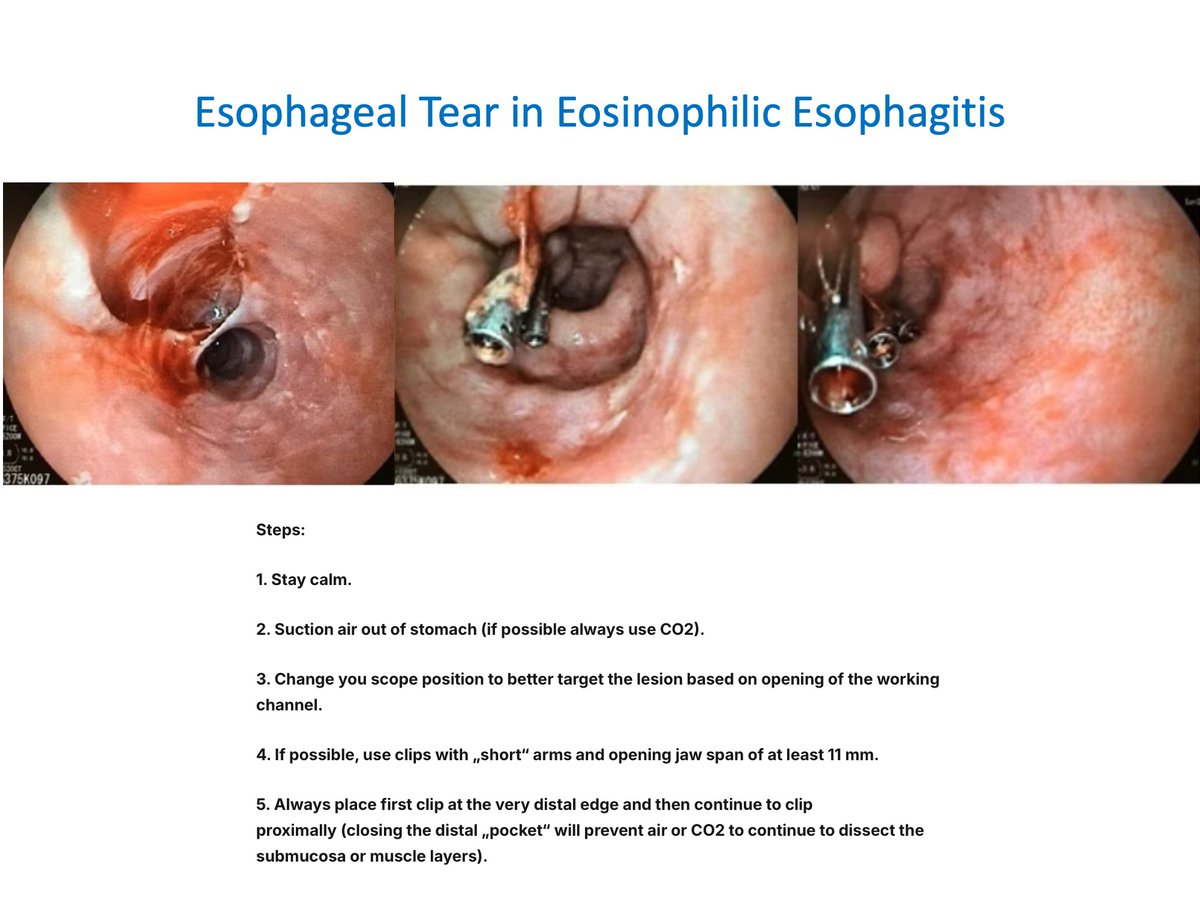 EndoCollab™ | GI Endoscopy Community tweet media