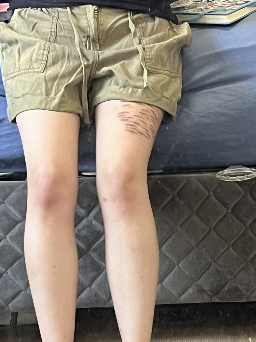applecester's tweet photo. guess shorts aren’t happening this year 😔 https://t.co/Egi0ffbPnC