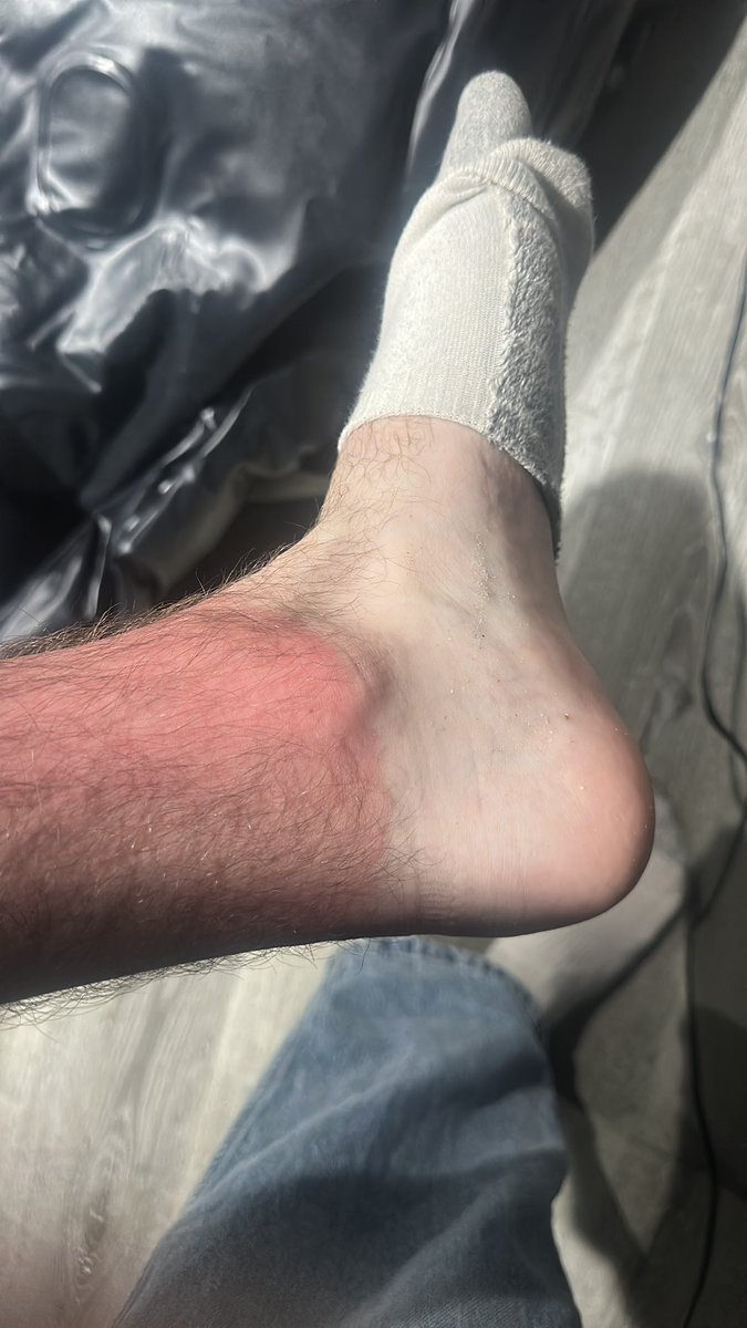 synematicz's tweet photo. Note to self - Sea Fishing requires suncream! https://t.co/78iIR3KFV1