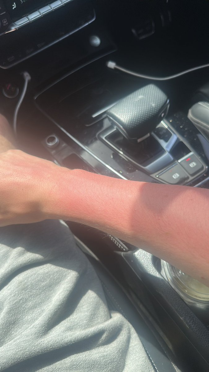 synematicz's tweet photo. Note to self - Sea Fishing requires suncream! https://t.co/78iIR3KFV1