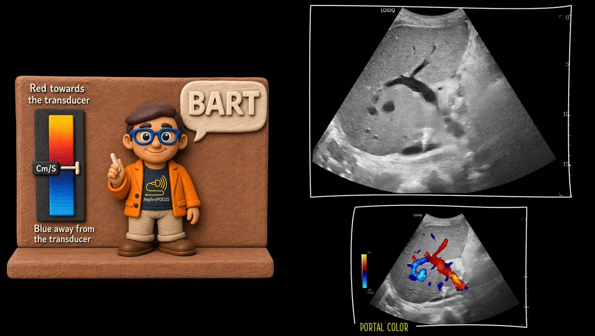 NephroPOCUS tweet media