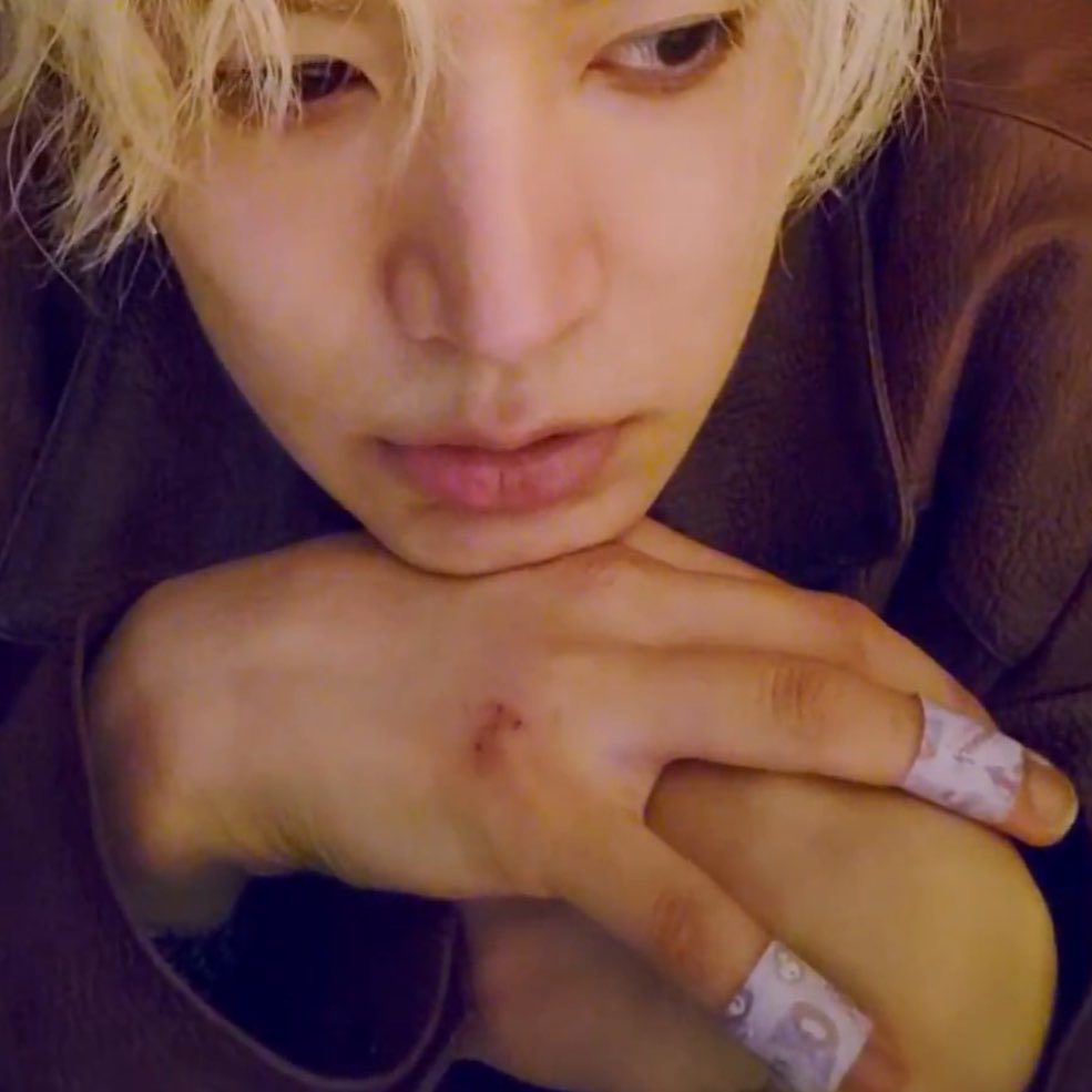 myheavanly's tweet photo. แต่มือเป็นแผลเกินเรื่องไปม้ากอะ ทำงานอะไรของเขาน้อทำไมมันเจ็บขนาดนั้น ซ้อมเต้นแล้วล้มเรอะ 🥺 https://t.co/9H86TAB0iN