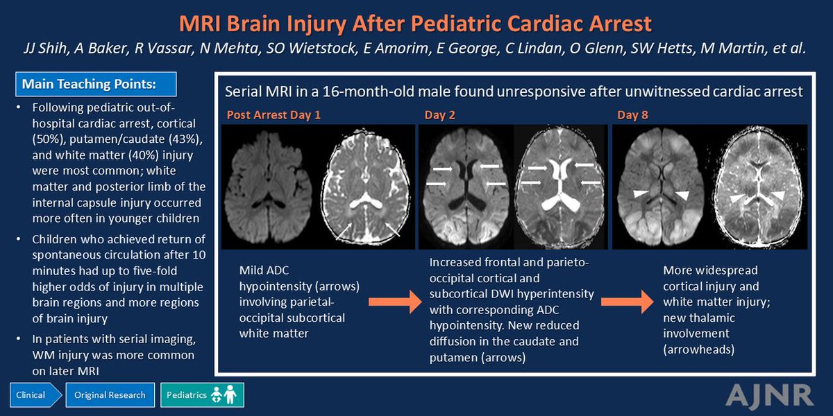 TheAJNR's tweet photo. "Patterns of MRI Brain Injury in Children after Out-of-Hospital Cardiac Arrest"

https://t.co/s96wbbZHDM

@YiLiMD @JonShih97 https://t.co/9XPm3r4kPw