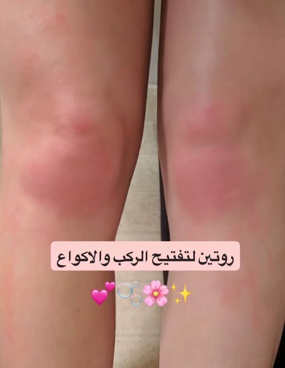 مَيساء | Miysa tweet media