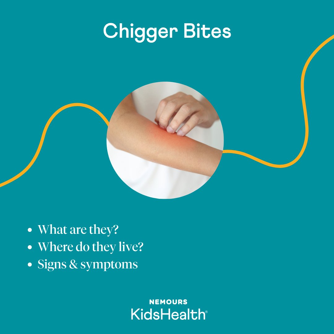 Nemours's tweet photo. As kids spend more time outside in the warmer months, they're more likely to get bites from bugs like chiggers. Our experts explain how to prevent bites and what to do if kids get bitten by chiggers: https://t.co/qBtMXVgrLv https://t.co/eDnj3sdmOU