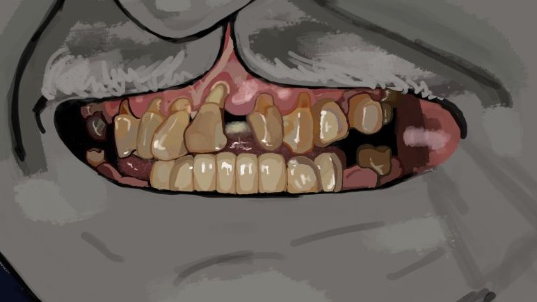 sinideasnombre's tweet photo. Vigilante's gross teeth, that's all https://t.co/1AC7OcPlAx
