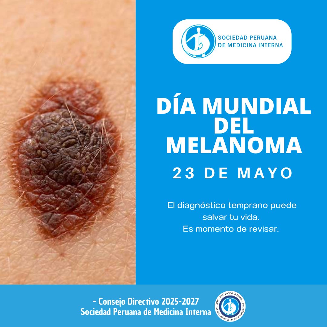 spmiperu's tweet photo. 🩺☀️ Día para educar, informar y concientizar sobre la identificación temprana de lesiones en la piel sospechosas de malignidad. 🔎🧴 https://t.co/nZBaqHx9n3