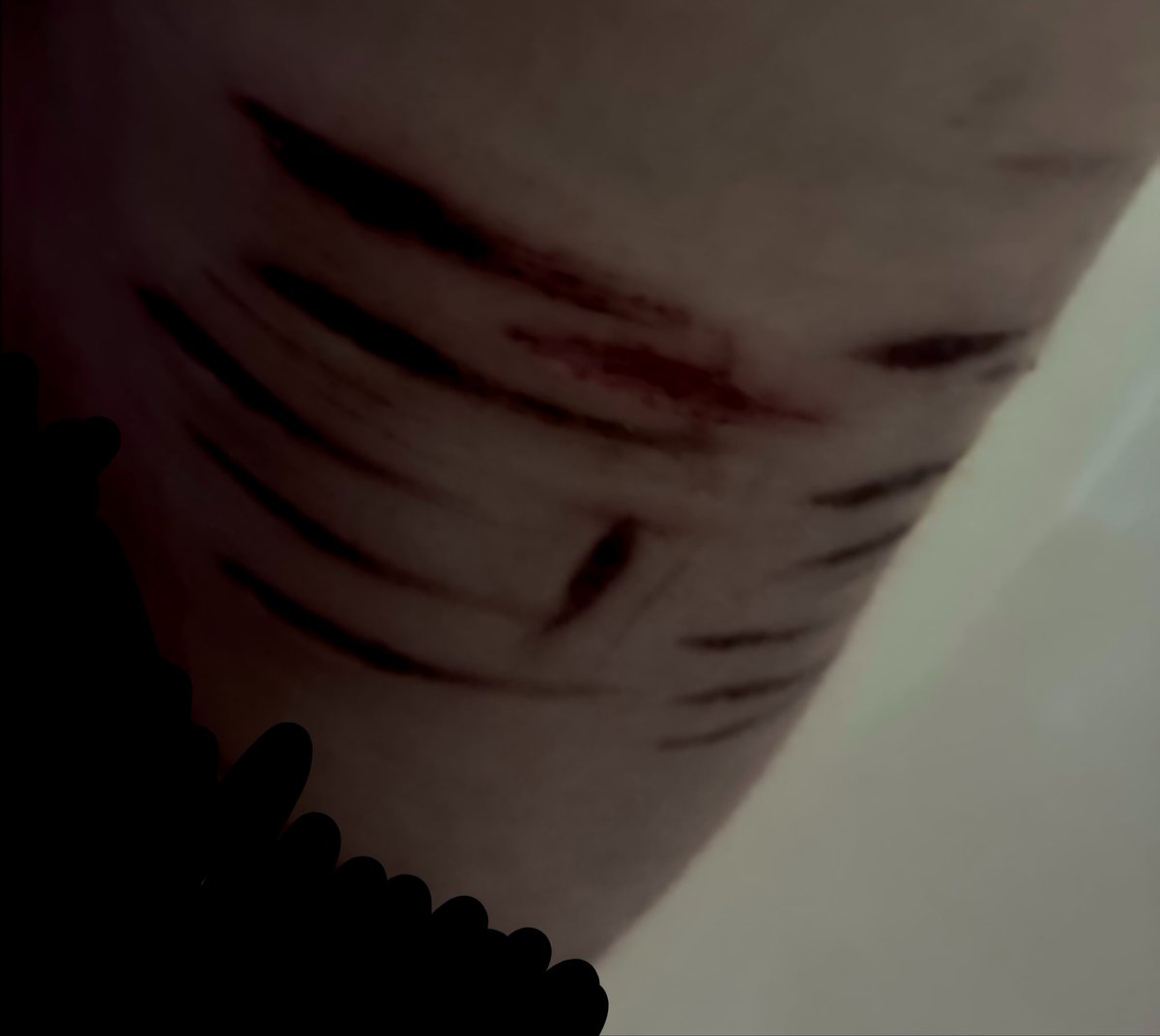 Syalt236's tweet photo. Old picture of them when I was in the shower #shtwt #shedtwt #sh #sfxmakeup #fake https://t.co/sCQ8z0NdJx