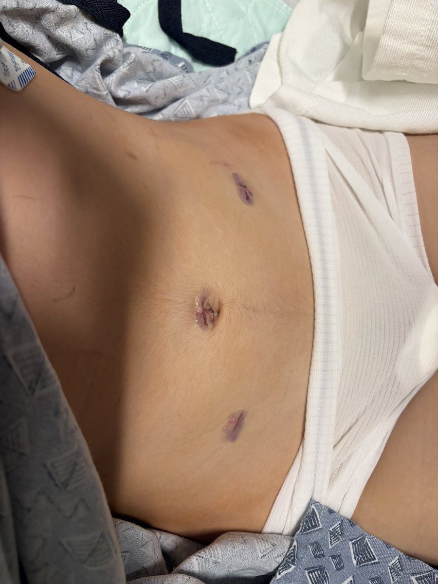 LaylaGhost58's tweet photo. Hey guys so I’m not doing great right now, I just got out of surgery. I had a cyst on my ovary rupture but now the healing process can begin! Send love and support please🙏 https://t.co/bj4f5QA6et